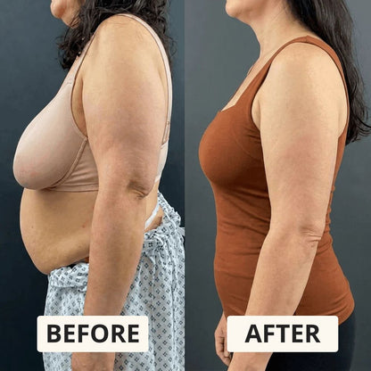Erbloom™ SmoothEase Bra-Tank | Smoothing Comfort with Built-In Support
